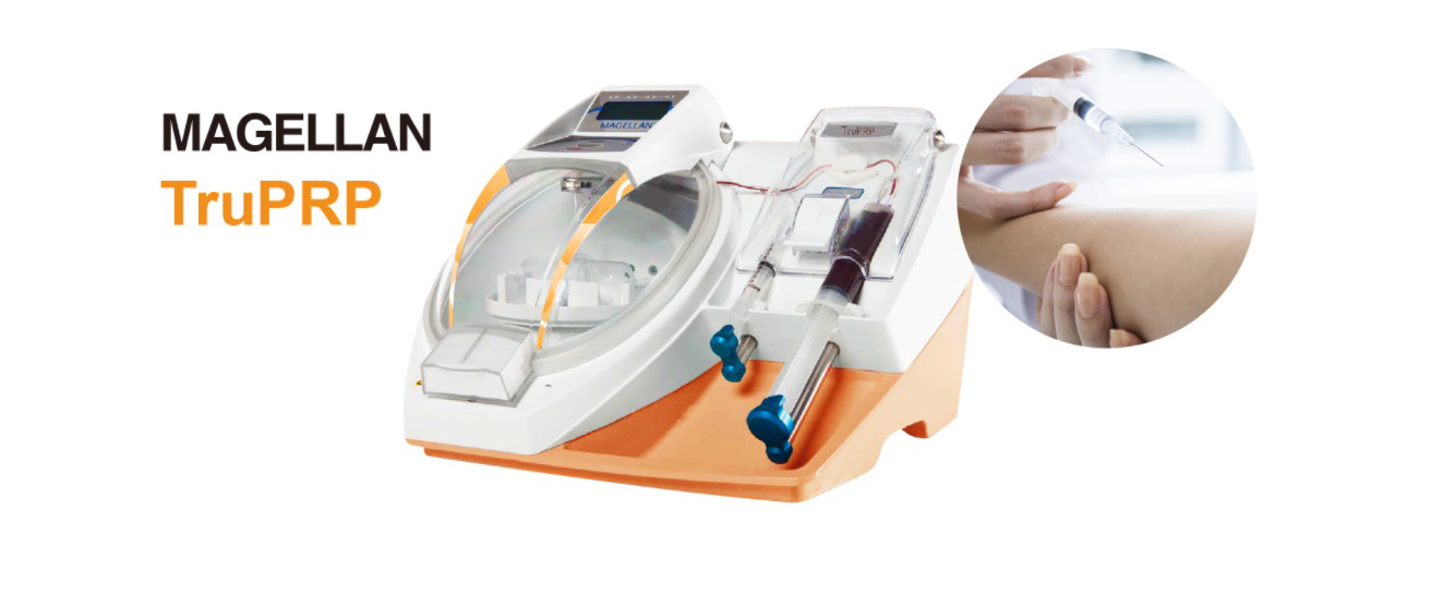 MAGELLANシステム